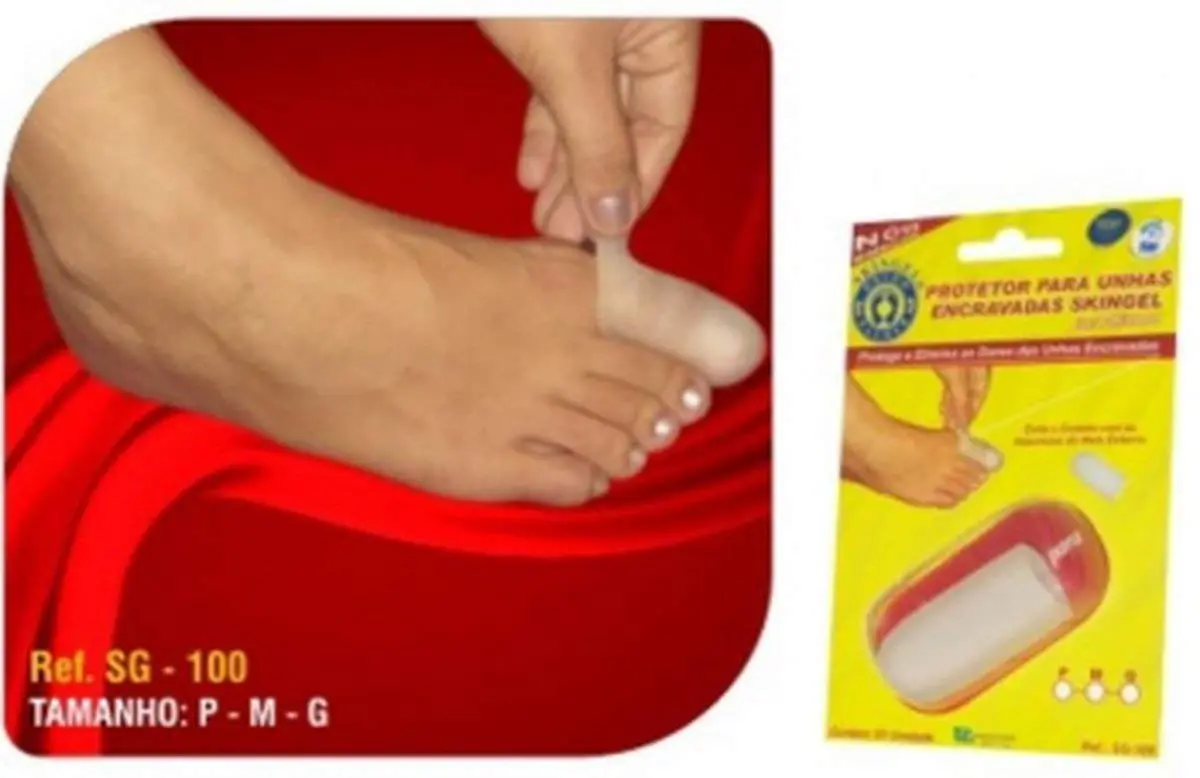 Ortho Pauher Protetor Para Unhas Encravadas Skingel Translucido Grande