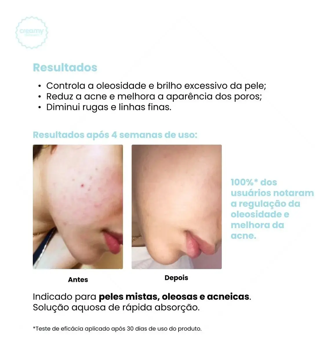 Creamy skincare ácido salicílico 90ml | tônico antioleosidade, rápida absorção, diminui o brilho excessivo, diminui os cravos | peles mistas, oleosas, noturno e diurno thumbnail 2