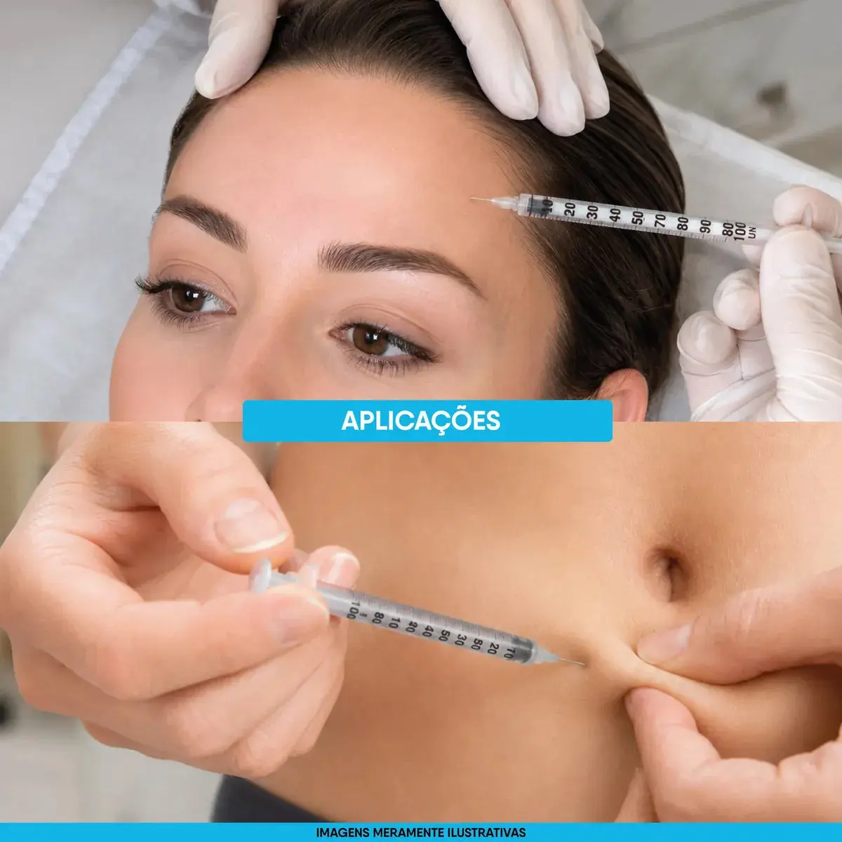 Seringa Insulina 1 ml Agulha Fixa Ultrafina 0,30mmx8mm Venper 100 Unidades thumbnail 4