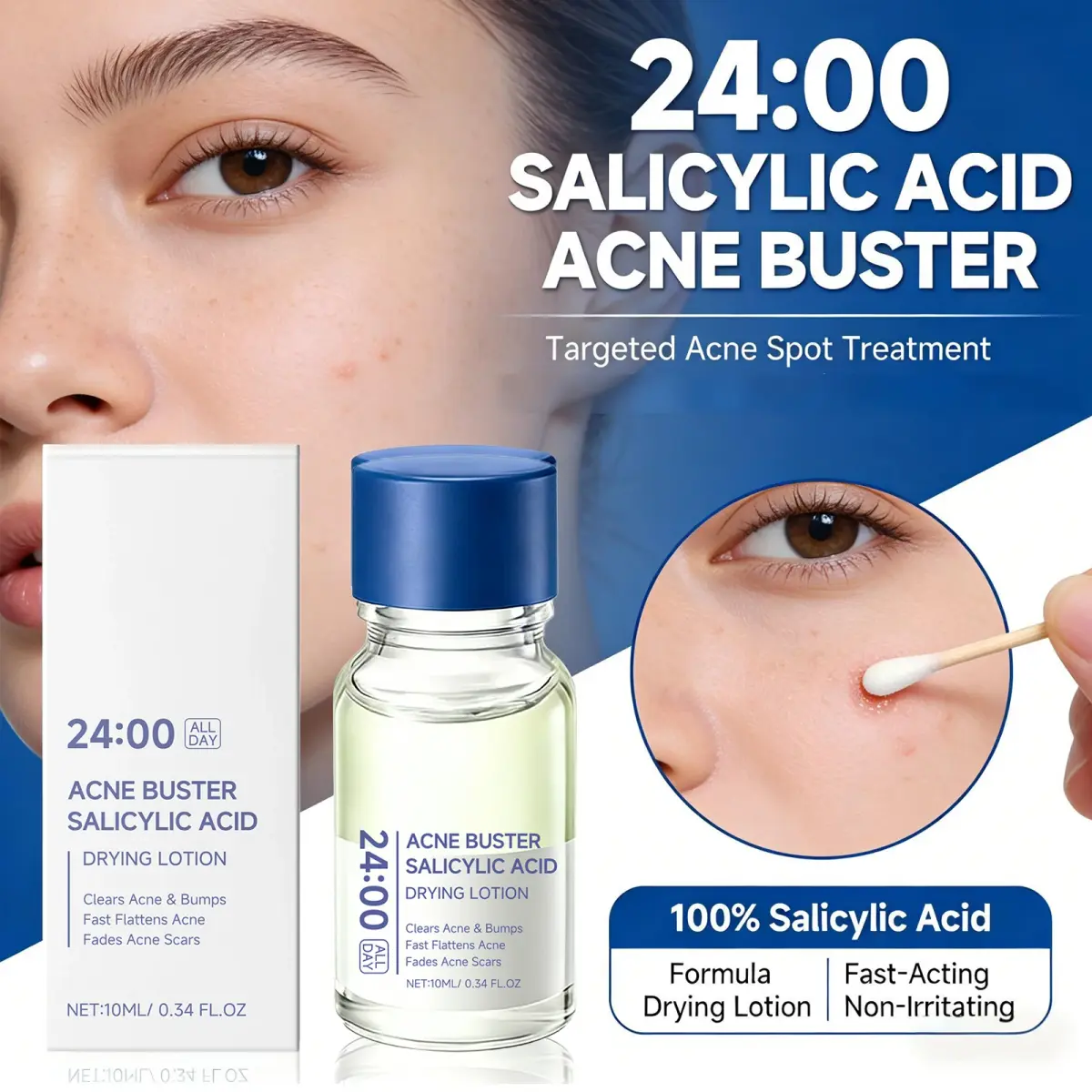 Loção Secante com Ácido Salicílico e Cotonete – Reduz Espinhas e Inflamações, Atenua Cicatrizes de Acne, Minimiza Poros, Renova a Pele - 1