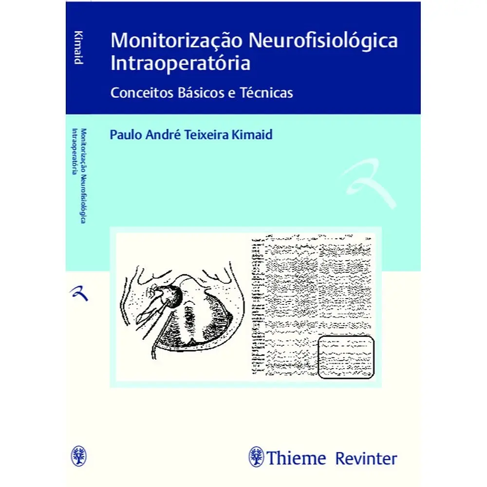 Monitorização Neurofisiológica Intraoperatória: Conceitos Básicos e Técnicas