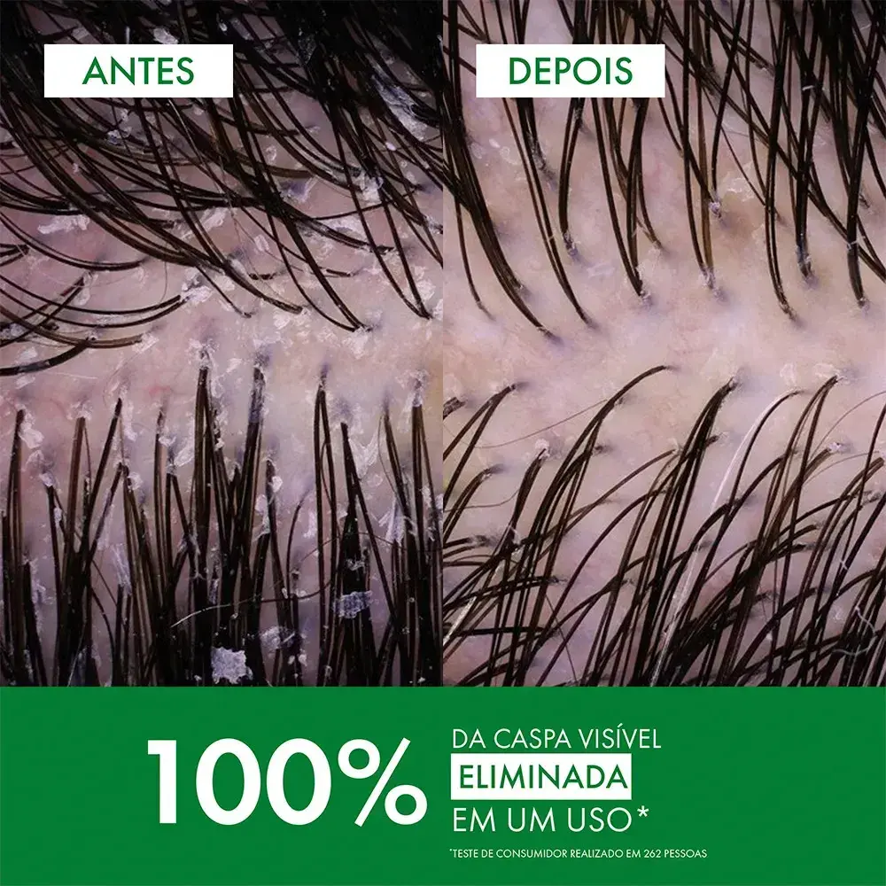 Shampoo Anticaspa Cabelos Normais a Oleosos, Dercos DS Vichy, 300g thumbnail 4